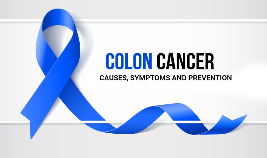 Colon Cancer: Causes, Symptoms and Prevention!